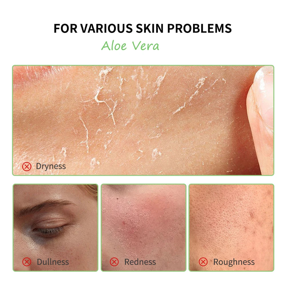 HydraBright Aloe Care Set